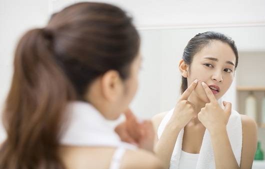 여드름이 생기는 부위에 따라 원인이 다르다 ｜출처: 클립아트코리아