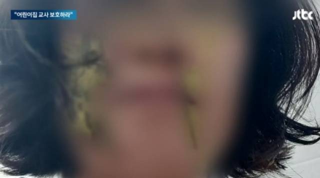 한 어린이집 교사가 학부모로부터 '똥기저귀'를 맞은 뒤 촬영한 사진. JTBC 보도화면 캡처