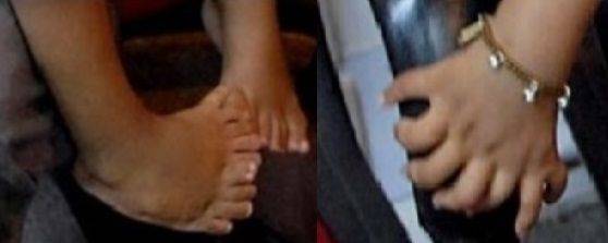 2011년 기네스북에 오른 손가락 14개, 발가락 20개 가진 남자아이 / 헤럴드선 갈무리