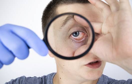 알레르기성 결막염은 대표적인 환절기 질환이다ㅣ출처: 게티이미지뱅크