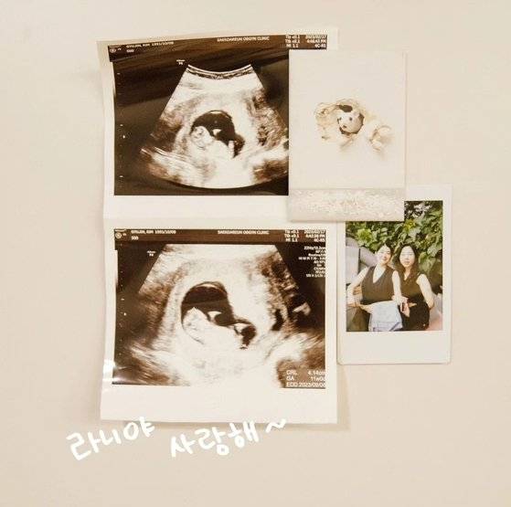 지난 7월 라니가 태어나기 전 초음파 사진. 김씨 인스타그램 캡처