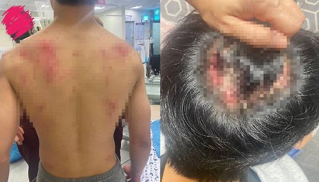 A씨가 공개한 아들의 상처. /사진=온라인 커뮤니티