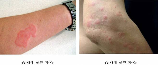 [질병관리청 제공]