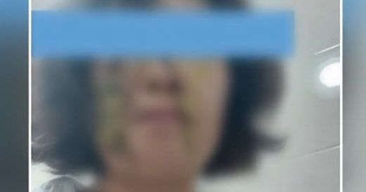 지난 9월10일 학부모로부터 '똥싸대기'를 맞은 어린이집 교사의 모습./ 사진=SBS '모닝와이드' 방송화면 캡처