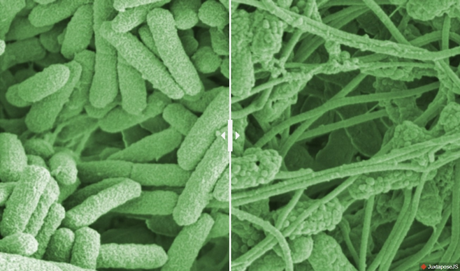 일반적인 녹농균(왼쪽 사진)과 ‘바이오필름’이 뚫리면서 전반적인 형태가 망가진 녹농균(오른쪽 사진)의 모습. 스위스 연방재료과학기술연구소 제공