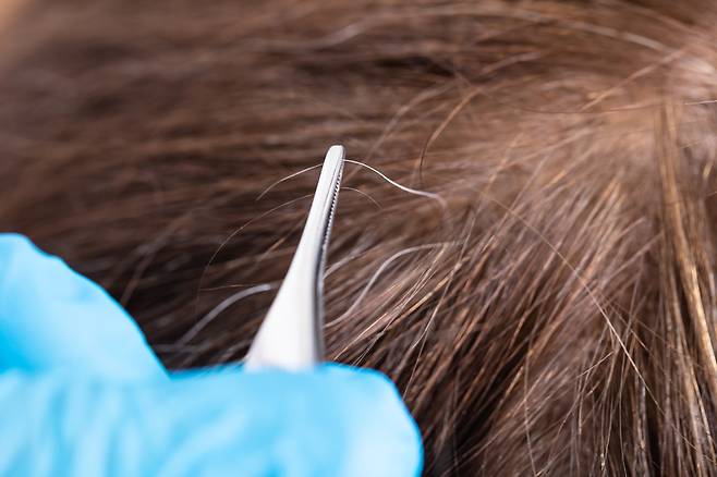 나이가 젊은데도 흰 머리가 난다면 극심한 스트레스나 다이어트, 특정 질환 등이 원인일 수 있다./사진=클립아트코리아