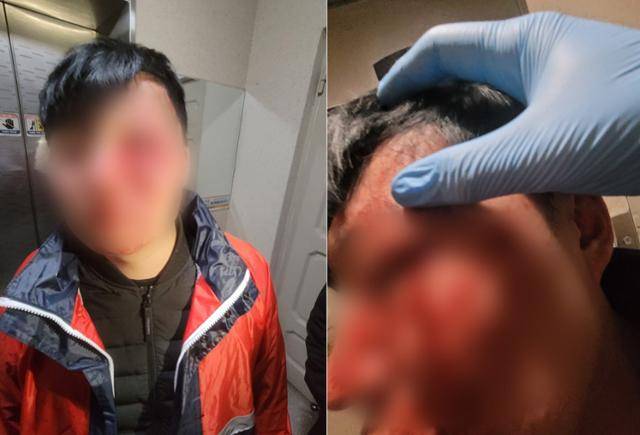 28세 배달라이더 정해영(가명)씨는 지난 16일 서울의 한 아파트에 음식과 주류 배달을 갔다가 고객에게 전치 6주의 폭행을 당했다. 왼쪽 얼굴은 온통 피범벅이 되고 안와(눈구멍)도 골절됐다. 업무 규정에 따라 몇 차례 신분증을 요구했는데 고객이 '시비 거냐'며 거부했고 곧 폭행이 시작됐다. 사건 직후 해영씨는 배달의민족 배달 수행 앱 기능을 이용해 고객과의 충돌 상황을 알렸으나, 배민 측으로부터 사실 관계 확인 전화만 받고 후속 지원 안내를 제대로 받지 못했다고 했다. 피해자 제공