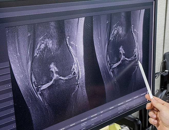 ‘스위프트엠알(SwiftMR)’을 통해 촬영한 MRI 영상. 사진 김흥구 객원기자