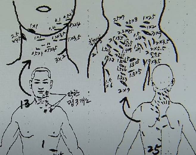 피해자인 박한상 부모의 부검 소견서 중 일부. /MBC 유튜브 영상