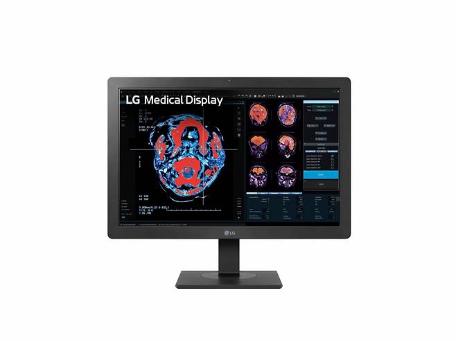 LG전자의 의료용 모니터 이미지. / 사진 = LG전자 제공