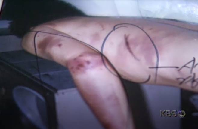 정의찬 더불어민주당 대표 특별보좌역이 연루된 이종권씨 고문치사 사건 당시 KBS 보도 화면. 이씨는 1997년 전남대 학생 행세를 했다는 이유로 운동권 세력들로부터 '프락치'로 몰려 쇠파이프 폭행과 고문을 당하다가 숨졌다. 당시 정 특보는 남총련 의장이자 조선대 총학생회장이었다.