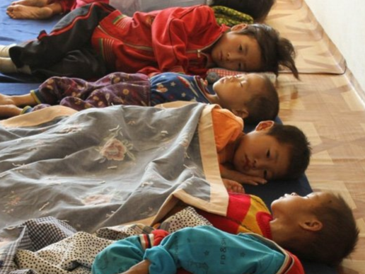 영양실조에 시달리는 북한 어린이들. 사진은 기사 내용과 관련없음. [사진 출처=연합뉴스]