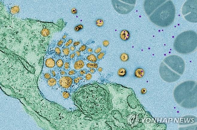 인간의 폐 세포(녹색)에서 세균(청색) 독소(자주색)를 빨아들이는 엑소좀(노란색) [네이처 제공]
