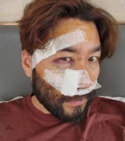 오토바이 사고 당시 모습.