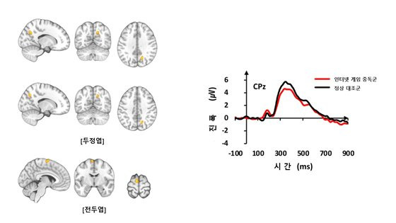 삼성서울병원 정신건강의학과 최정석 교수팀이 4일 발표한 인터넷 게임 중독 관련 연구 결과. 자료 삼성서울병원