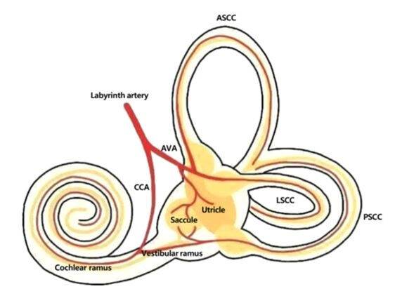 총와우동맥(CCA)은 와우(달팽이관) 전체와 후반고리관의 혈액 공급을 담당한다. 만약 총와우동맥이 막히는 등, 혈액 공급에 문제가 생기면 달팽이관 기능 저하로 인한 돌발성 난청과 후반고리관 기능 저하로 인한 어지럼증이 나타나게 된다. 이는 청력검사와 평형기능검사 결과를 조합하여 알 수 있으며, 돌발성 난청의 원인이 혈관 문제임을 알 수 있게 한다. 강북삼성병원&nbsp;제공&nbsp;
