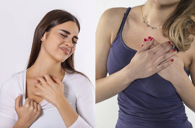 겨울에는 보습에 신경 쓰고, 여름에는 가벼운 소재의 브래지어와 옷을 입어 시원하게 유지하는 것이 좋다. [사진=게티이미지뱅크]