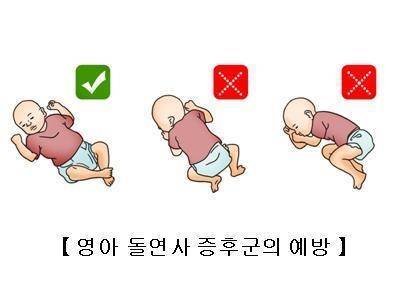 영아 돌연사 증후군 예방을 위한 수면 자세 [서울아산병원 제공. 재판매 및 DB 금지]