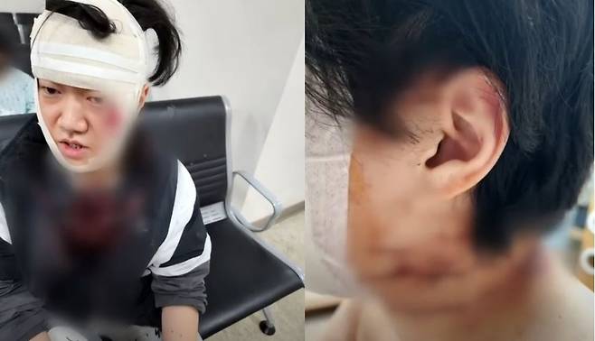 당시 응급실로 실려온 이수연 씨. 이수연 씨 제공
