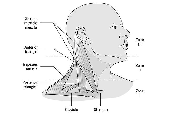 '구역(Zone) I'은 쇄골(쇄골)에서 윤상 연골(갑상선 바로 위에 위치)까지 이어지는 목의 아래쪽 부분이다. 이 부위의 부상은 기관, 식도, 주요 혈관(쇄골하 동맥 및 정맥 등), 흉관과 같은 중요한 구조물과 관련될 수 있다. '구역(Zone) II'는 윤상 연골에서 하악골(턱뼈)의 각도에 이르는 목의 중간 부분이다. 구역 II의 부상은 경동맥과 척추 동맥뿐만 아니라 경정맥에도 영향을 미칠 수 있습니다. 기도와 식도도 잠재적인 위험 부위다. '구역 III'은 목의 윗부분으로, 하악골의 각도에서 두개골 기저부까지 이어진다. 이 구역의 부상은 경동맥과 척추 동맥은 물론 신경과 척추와 같은 중요한 구조물과 관련될 수 있다. 대한외상중환자외과학회 제공