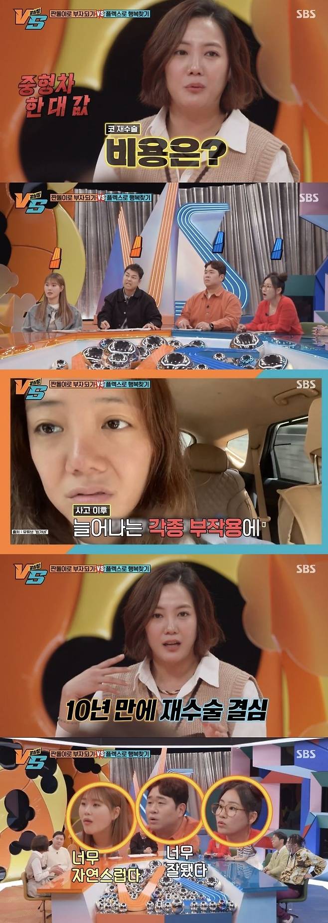 [서울=뉴시스] 배우 고은아가 지난 9일 방송된 SBS TV 예능물 '강심장VS'에서 코 재수술과 모발이식을 받았다고 밝혔다. (사진=SBS TV 예능물 '강심장VS' 캡처) 2024.01.10. photo@newsis.com *재판매 및 DB 금지