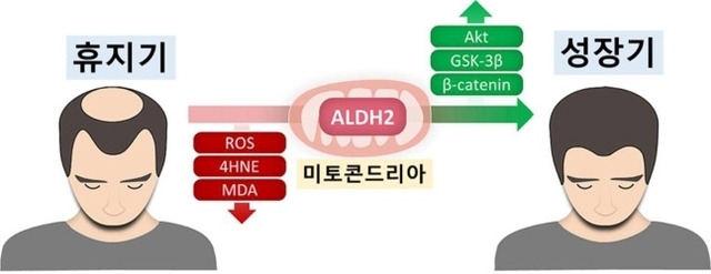 ALDH2 활성화로 산화 스트레스를 감소시키고 모낭을 성장기로 회복시킬 수 있다는 연구결과가 발표됐다. 서울대병원 제공