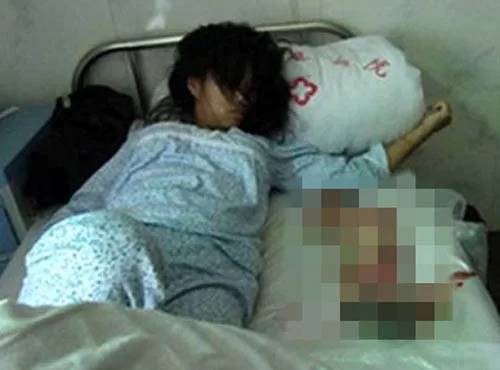 지난 2012년 6월 임신 7개월 된 아이를 강제 낙태 당한 중국인 여성. 이 사건은 중국 외부까지 알려져 파문을 일으켰다. [사진=시나 닷컴]