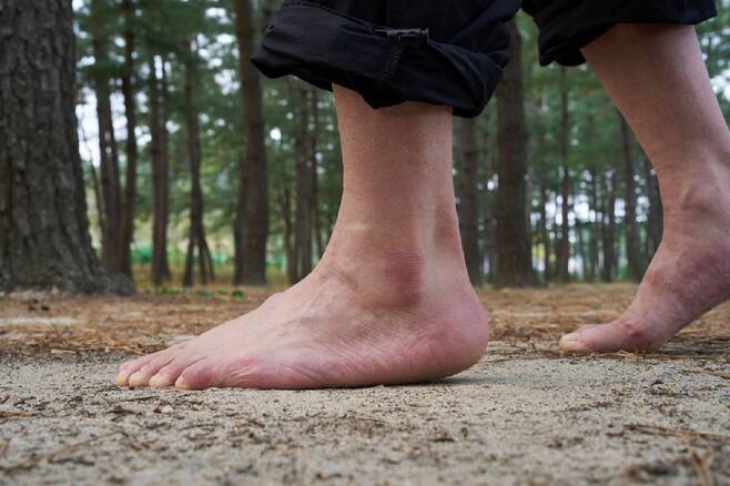 맨발걷기의 접지효과는 아직 과학적으로 입증되지 않았으며, 맨발로 걷다가 발에 상처가 나면 치명적인 균에 감염될 위험이 있다./사진=게티이미지뱅크