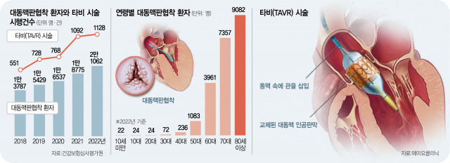 사진 설명