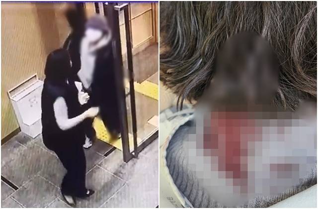 배현진 국민의힘 의원 피습 직후 뒷목 주변에 다량의 혈흔이 묻은 모습. 왼쪽 사진은 배 의원이 25일 오후 5시쯤 서울 강남구 청담동 거리에서 15세 중학생에게 둔기로 머리를 가격당하는 상황이 담긴 CCTV 화면. 배현진 의원실 제공