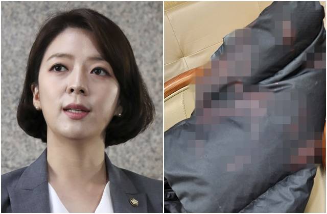 배현진 국민의힘 의원. 오른쪽 사진은 그가 피습 당시 입었던 패딩 조끼에 다량의 혈흔이 묻은 모습. 뉴시스, 배현진 의원실 제공