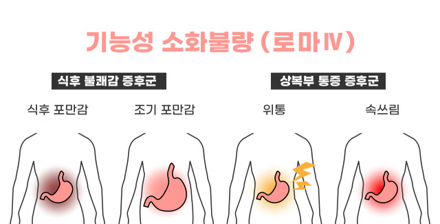 전문가들은 기능성 소화불량을 크게 ‘식후 불쾌감 증후군’과 ‘상복부 통증 증후군’으로 나눈다.