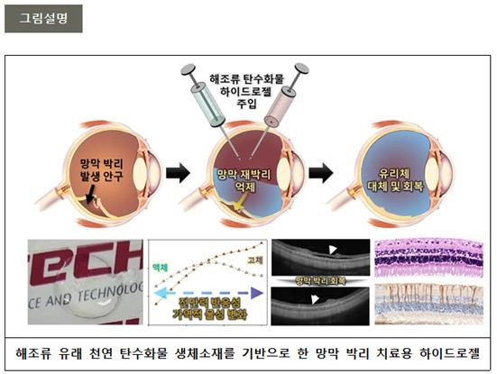 망막 박리 치료용 하이드로젤 연구도 [포항공대 제공. 재판매 및 DB 금지]