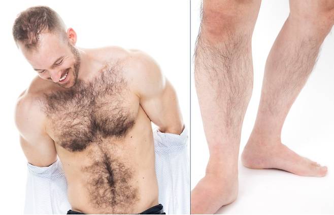 체모에 영향을 미치는 가장 중요한 요소는 유전이다. [사진=게티이미지뱅크]