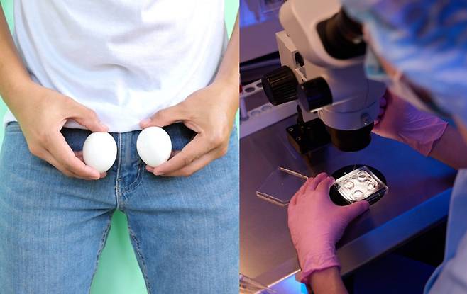 실험실에서 만들어진 이 고환은 아직 완전한 기능을 갖춘 정자 생산 기관은 아니지만, 자연 고환과 동일한 구조와 공통된 유전적 특성을 지니고 있다. [사진=게티이미지뱅크]