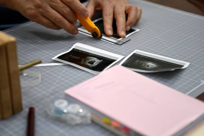 심상덕 진오비산부인과 원장이 산모수첩에 붙일 태아 초음파 사진을 자르는 모습.  백동현 기자