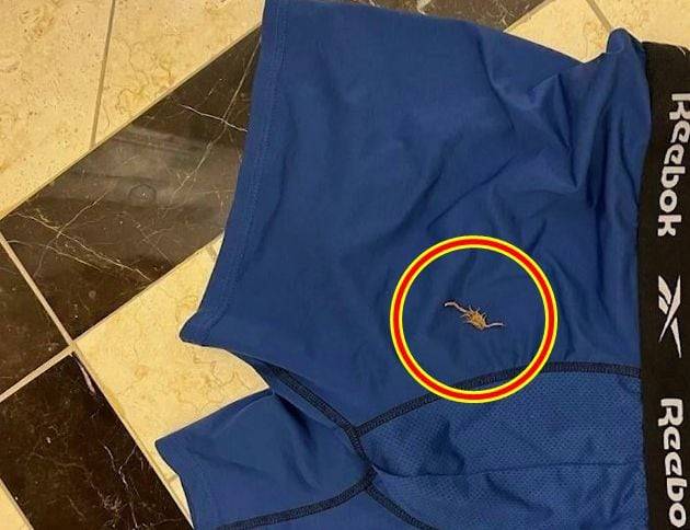 마이클 피치가 극심한 통증에 속옷을 벗어 확인하자 전갈이 발견됐다. /8뉴스 나우 보도화면