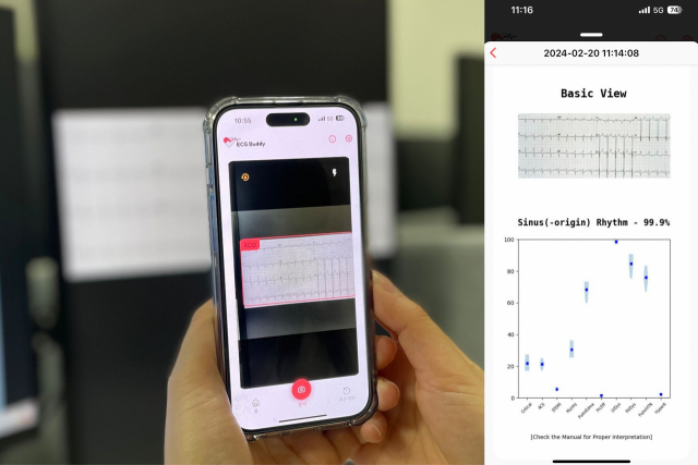 ‘ECG 버디’ 앱이 스마트폰에서 작동하는 모습. 스마트폰으로 심전도 이미지를 촬영하면 분석 결과(오른쪽)가 출력된다. 사진 제공=분당서울대병원