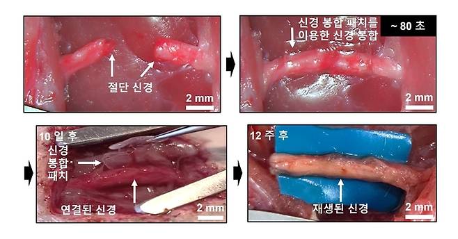 신경 봉합 패치의 봉합 과정 및 성능. 손동희 성균관대 교수 제공