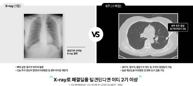 엑스레이 영상과 CT 영상의 비교 (자료=코어라인소프트)