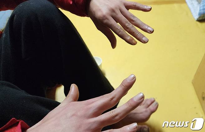 A는 정신병원에서 치료를 잘 못 받아 손에도 문제가 있다고 했지만 정확히 무엇이 잘못된 것인지 말하지 못했다.