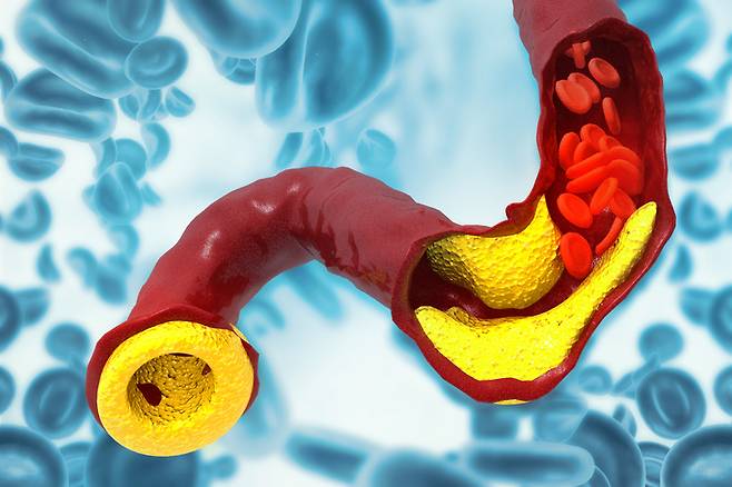 [사진=게티이미지뱅크]