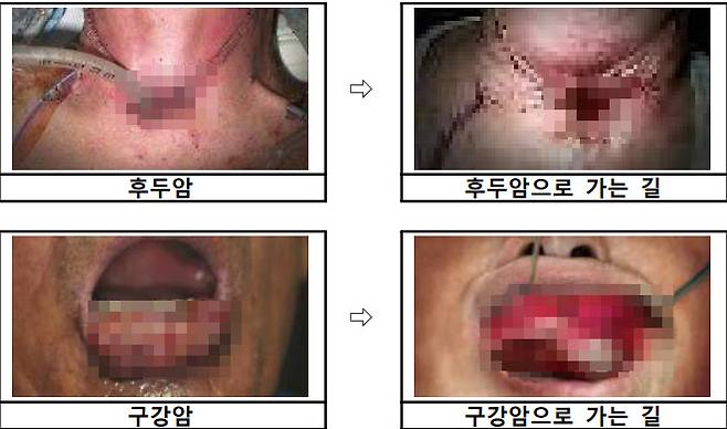 제5기 담뱃갑포장지 경고그림 및 표기내용(사진=보건복지부)