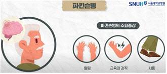 파킨슨병의 주요 증상.