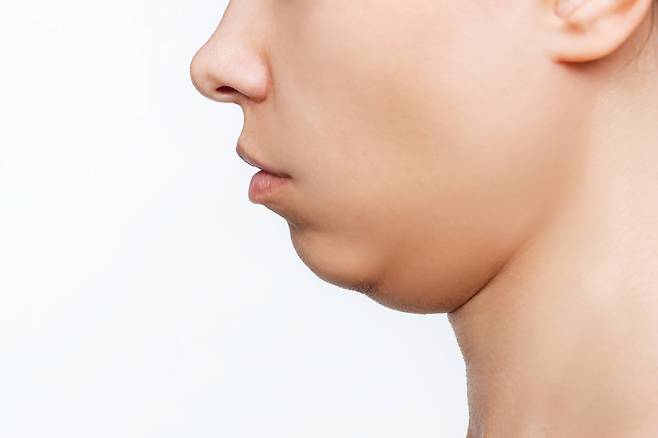 턱 밑이 붓는다면 급성 타액선염, 악하선 타석증, 악하선 종양 등의 질환 때문일 수 있다./사진=게티이미지뱅크