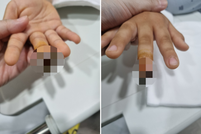 수영장 샤워실에서 10살 어린이의 손가락이 절단되는 사고가 발생했다.[사진=온라인 커뮤니티]