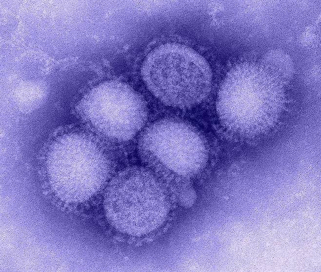 인플루엔자 바이러스의 전자현미경 사진. 미국 연구진은 유전자의 발현을 억제하는 RNAi를 이용한 범용 백신 개발에 성공했다고 밝혔다./미 질병통제예방센터(CDC)