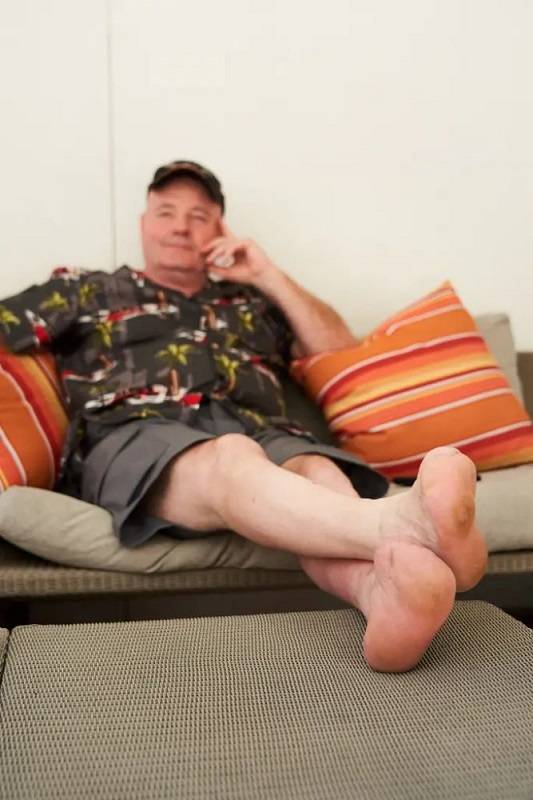 최근 발가락을 모두 절단한 존 웨인 보빗(57)의 모습./사진=뉴욕 포스트