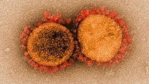 코로나19 바이러스 전자현미경 사진. / 사진=미국 국립 알레르기 감염병 연구소(NIAID) 제공