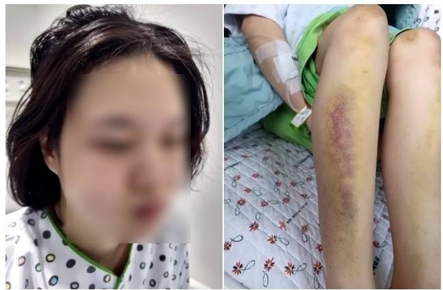 사진=JTBC보도화면